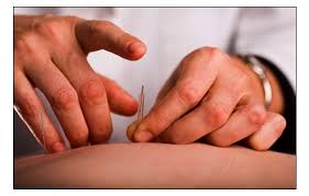 ZhangHealth/images/Acupuncture_1.jpg
